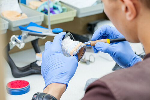 歯を造る歯科技工士との連携