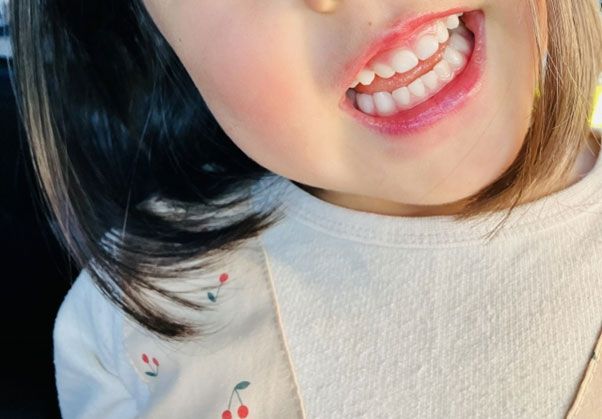 子どもが怖がらない！歯医者選びのポイントと上手な通院方法