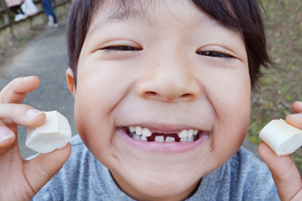 お子様の歯ぎしり｜原因と対処法を歯科医が解説