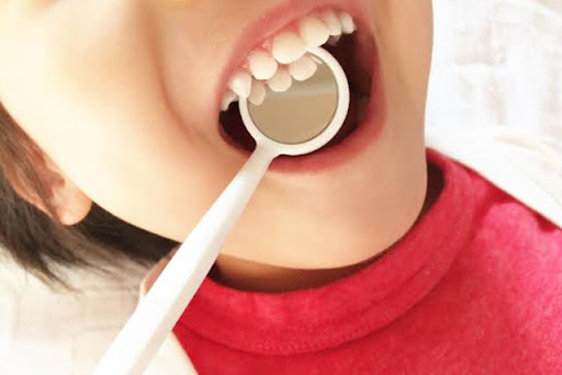 口呼吸がクセになるとどうなる？歯並び・かみ合わせへの悪影響とは